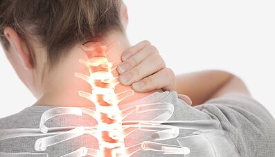 Como tratar a osteocondrose da columna cervical