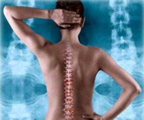 Ilustración da columna posterior