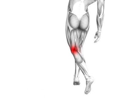 Osteoartrite da articulación do xeonllo