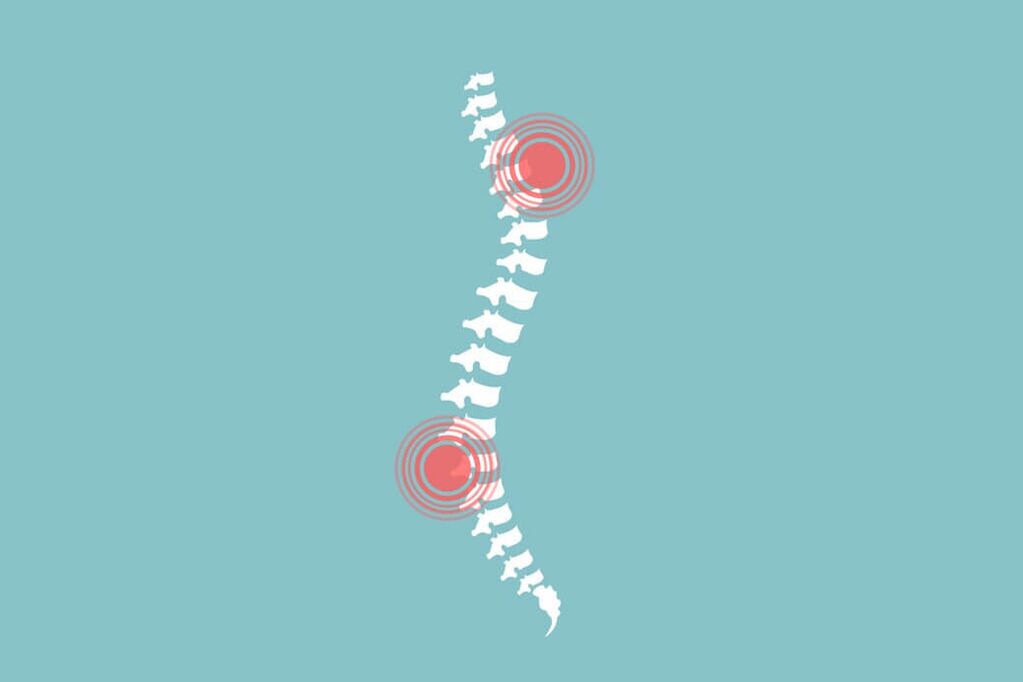 columna vertebral e dor nas costas