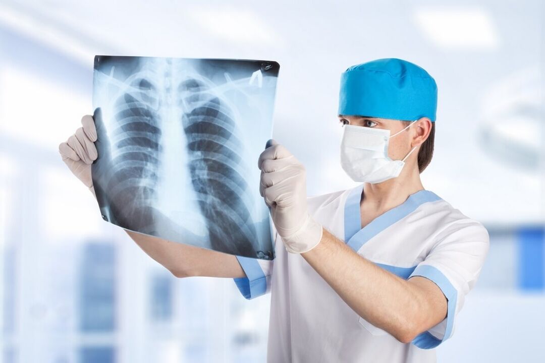 Radiografía de tórax con osteocondrose