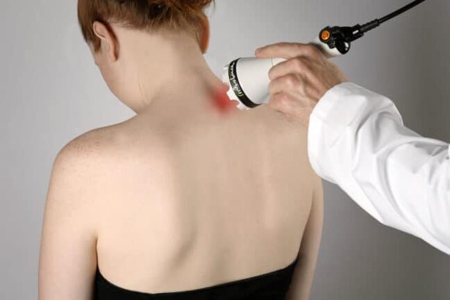 A terapia con láser úsase para combater a dor nas costas na zona do omóplato. 