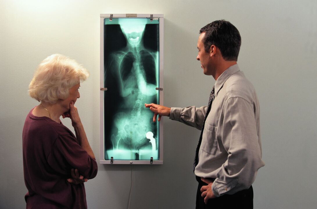 Diagnóstico de raios X para a dor na articulación da cadeira