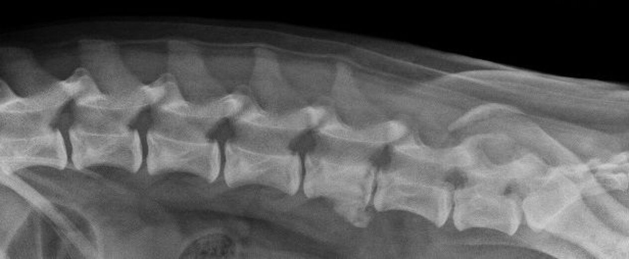 Manifestacións da osteocondrose da columna torácica na radiografía